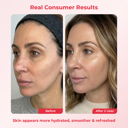 PDRN Deep Mask (4 Masks)